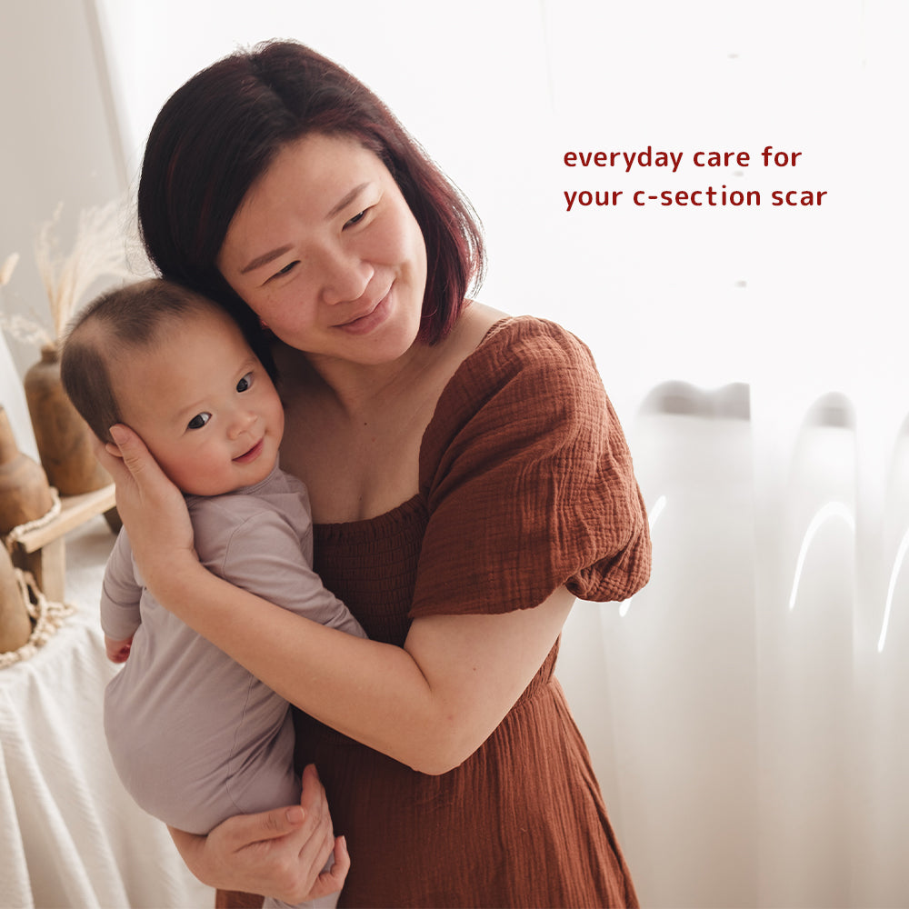 Woman holding a baby with a supportive text graphic about Dear Cherie silicone scar patches for everyday C-section scar care during postpartum recovery